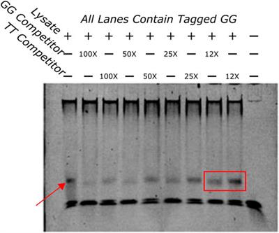 Leveraging a High-Throughput Screening Method to Identify Mechanisms of Individual Susceptibility Differences in a Genetically Diverse Zebrafish Model